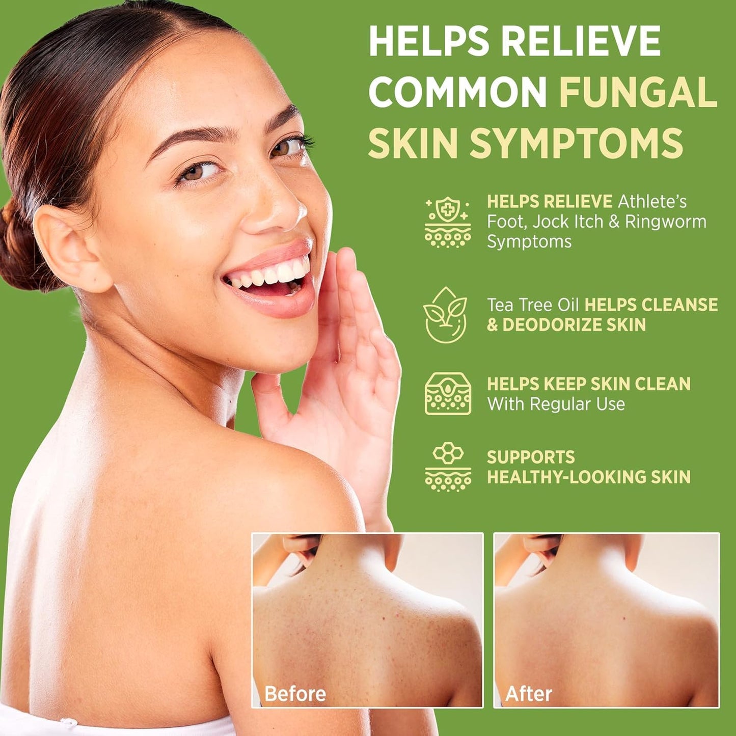 Visit the Roycederm Store — Roycederm Antifungal Bar Soap - Tea tree Oil Soap - Athlete’s Foot Treatment for Jock Itch & Ringworm - Medicated Antifungal Soap with Clotrimazole 1% - Tea Tree Oil Scent, 1 Pack
