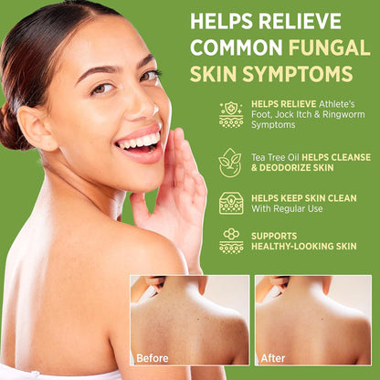 Visit the Roycederm Store — Roycederm Antifungal Bar Soap - Tea tree Oil Soap - Athlete’s Foot Treatment for Jock Itch & Ringworm - Medicated Antifungal Soap with Clotrimazole 1% - Tea Tree Oil Scent, 1 Pack